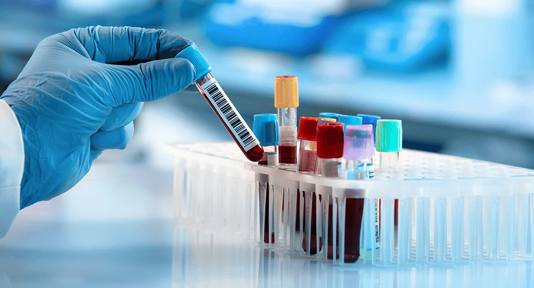 NIPT Testing Laboratory